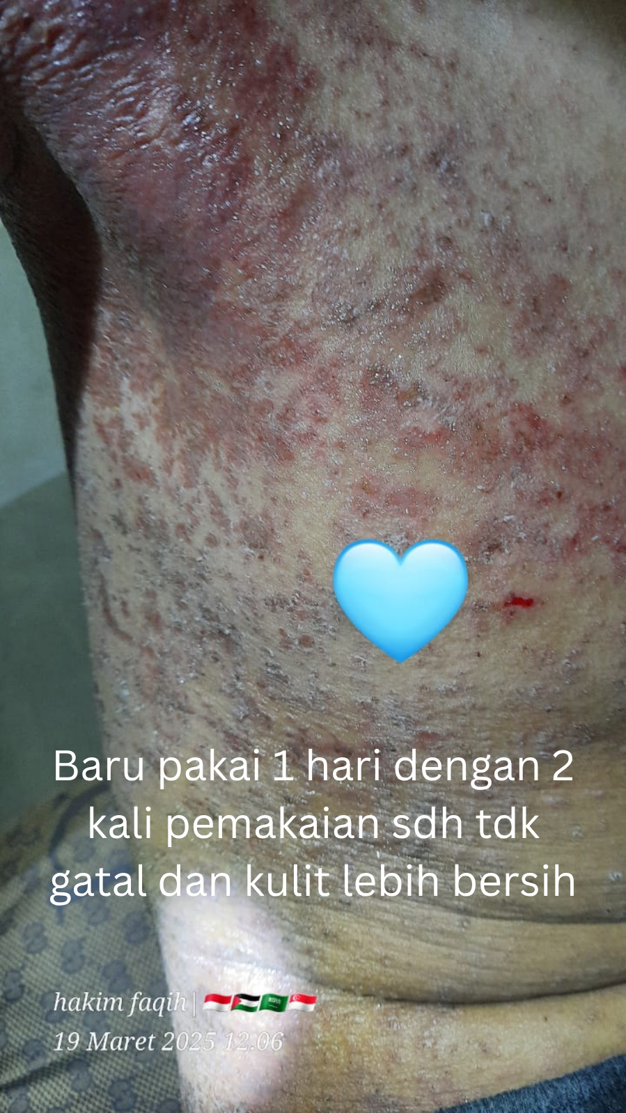 after before sabun tamarind